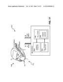 NASAL PASSAGE OPENER OF A VENTILATION MASK diagram and image