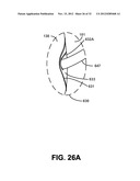 NASAL PASSAGE OPENER OF A VENTILATION MASK diagram and image