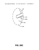 NASAL PASSAGE OPENER OF A VENTILATION MASK diagram and image