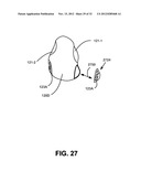 NASAL PASSAGE OPENER OF A VENTILATION MASK diagram and image