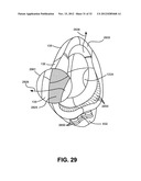 NASAL PASSAGE OPENER OF A VENTILATION MASK diagram and image