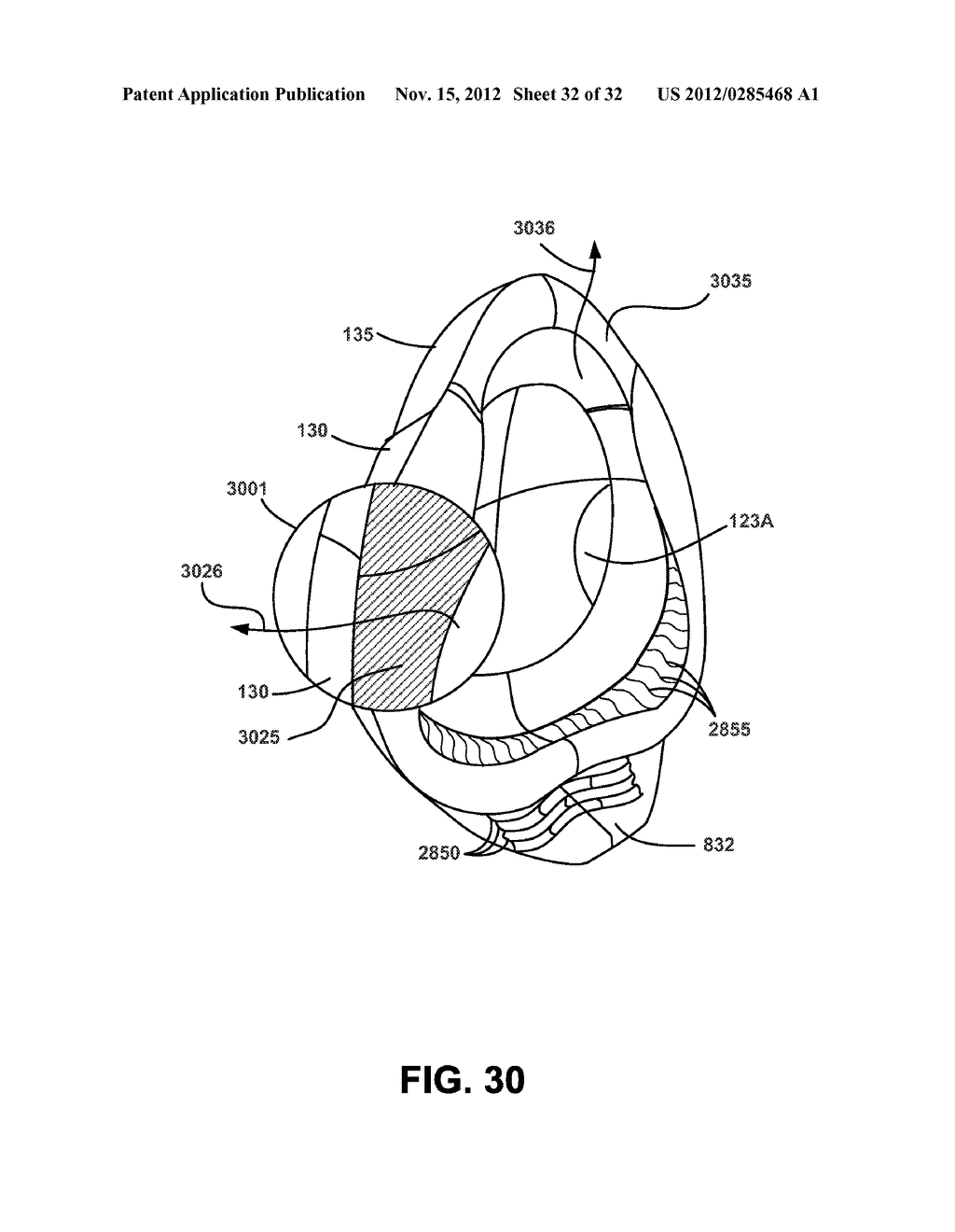 NASAL PASSAGE OPENER OF A VENTILATION MASK - diagram, schematic, and image 33