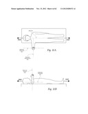 SYSTEMS, DEVICES, AND METHODS FOR MECHANICALLY REDUCING AND FIXING BONE     FRACTURES diagram and image