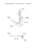 SYSTEMS, DEVICES, AND METHODS FOR MECHANICALLY REDUCING AND FIXING BONE     FRACTURES diagram and image