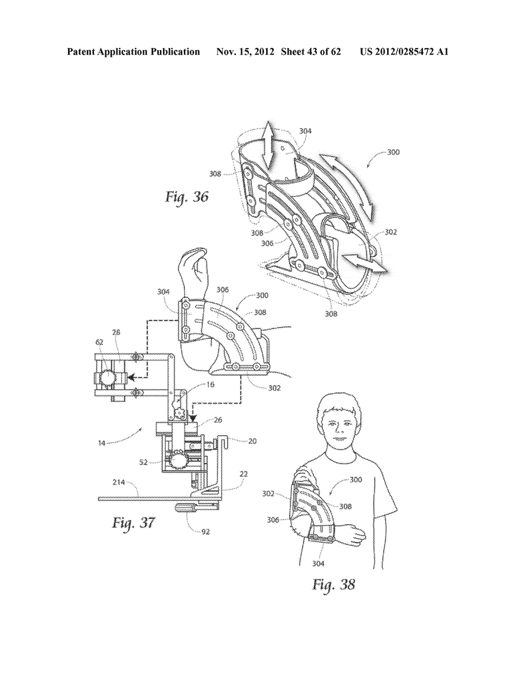 SYSTEMS, DEVICES, AND METHODS FOR MECHANICALLY REDUCING AND FIXING BONE     FRACTURES - diagram, schematic, and image 44