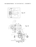 SYSTEMS, DEVICES, AND METHODS FOR MECHANICALLY REDUCING AND FIXING BONE     FRACTURES diagram and image