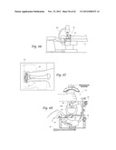 SYSTEMS, DEVICES, AND METHODS FOR MECHANICALLY REDUCING AND FIXING BONE     FRACTURES diagram and image