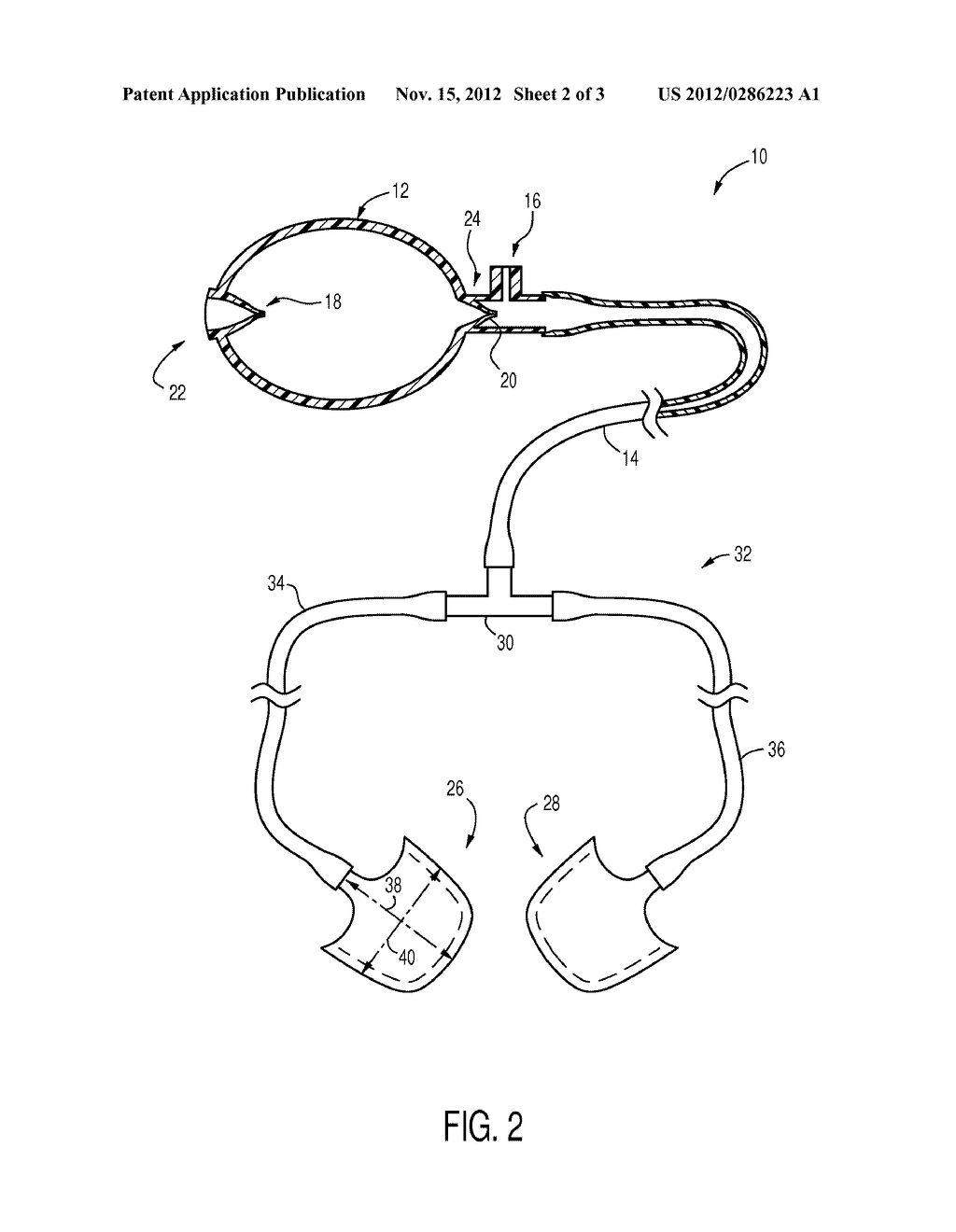 PNEUMATIC VEHICLE DOOR SPREADER - diagram, schematic, and image 03