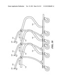 CART FOR LARGE AREA OBJECTS diagram and image