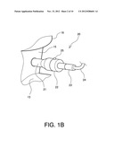 Pressure-Resistant Explosion-Proof Connector diagram and image