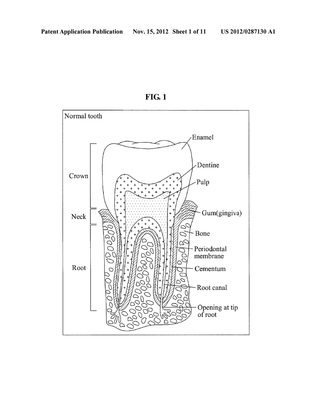 APPARATUS AND METHOD FOR REALISTICALLY EXPRESSING TEETH - diagram, schematic, and image 02