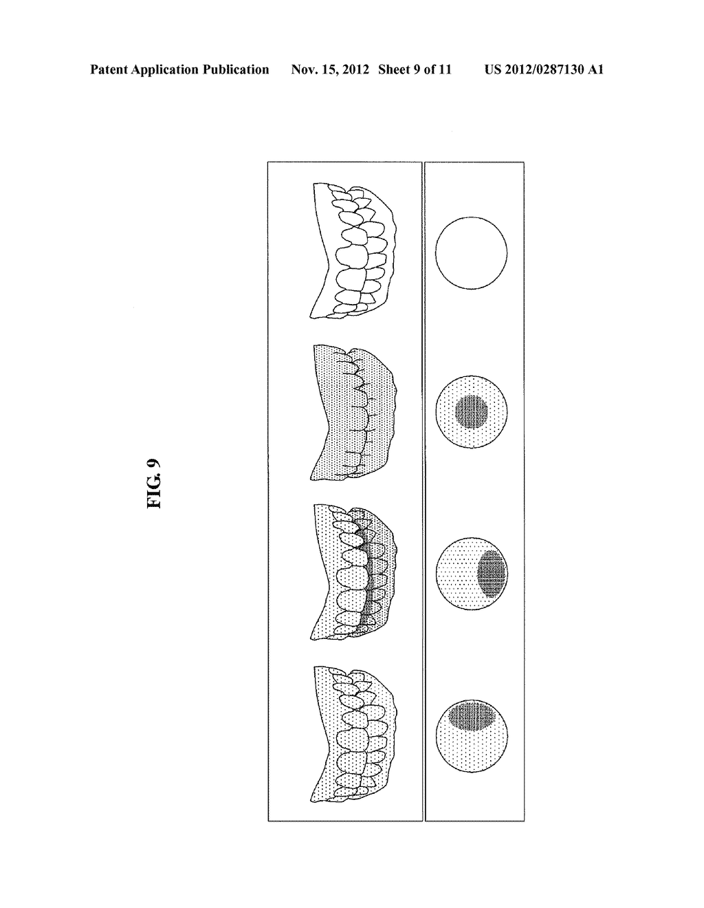 APPARATUS AND METHOD FOR REALISTICALLY EXPRESSING TEETH - diagram, schematic, and image 10