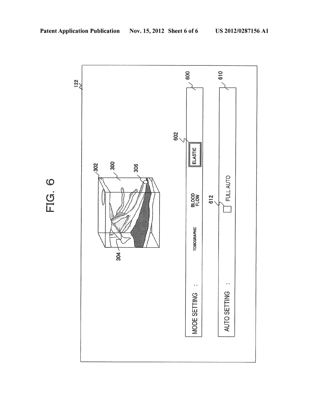 ULTRASONIC DIAGNOSTIC APPARATUS AND ULTRASONIC IMAGE DISPLAY METHOD - diagram, schematic, and image 07