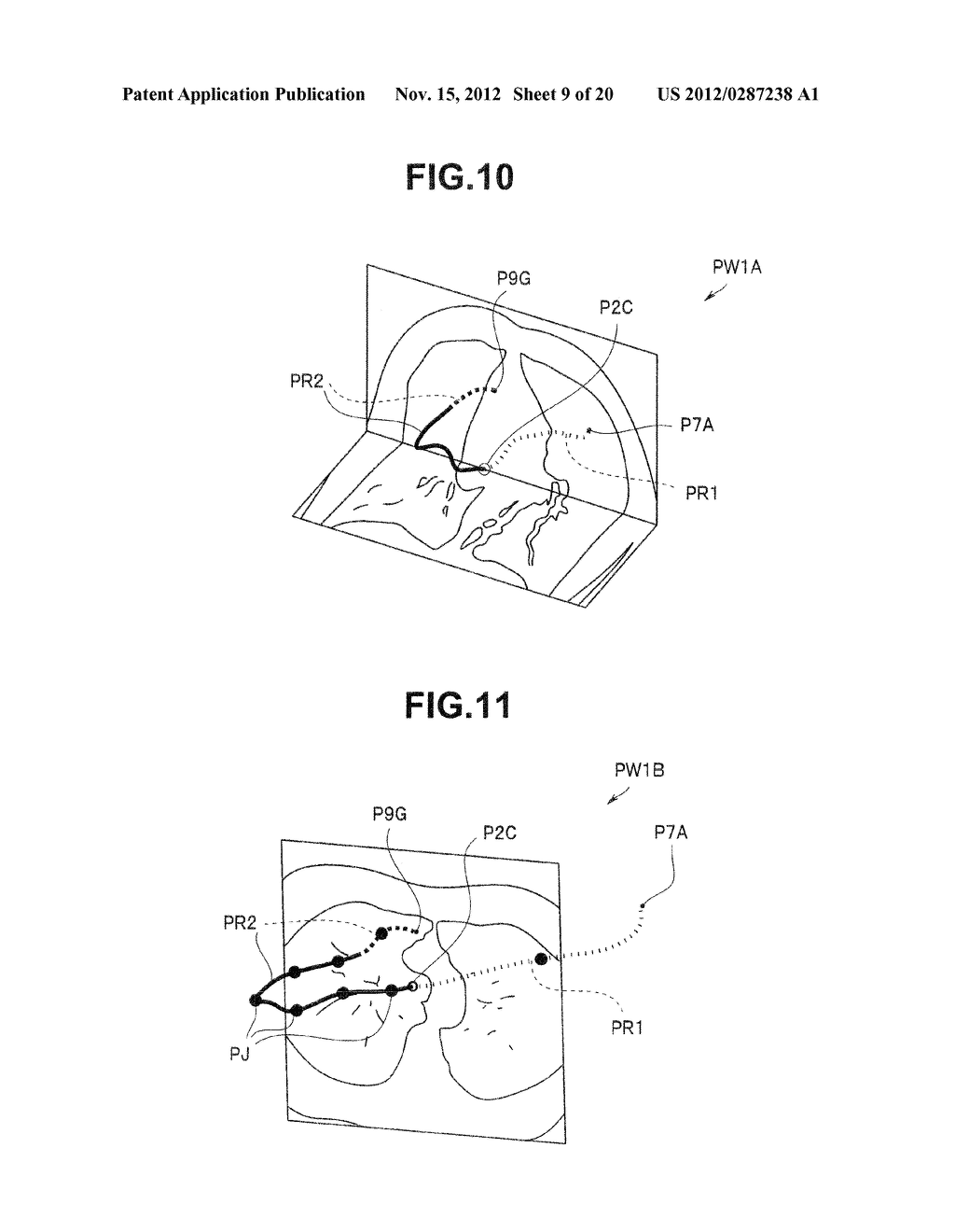 MEDICAL DEVICE - diagram, schematic, and image 10