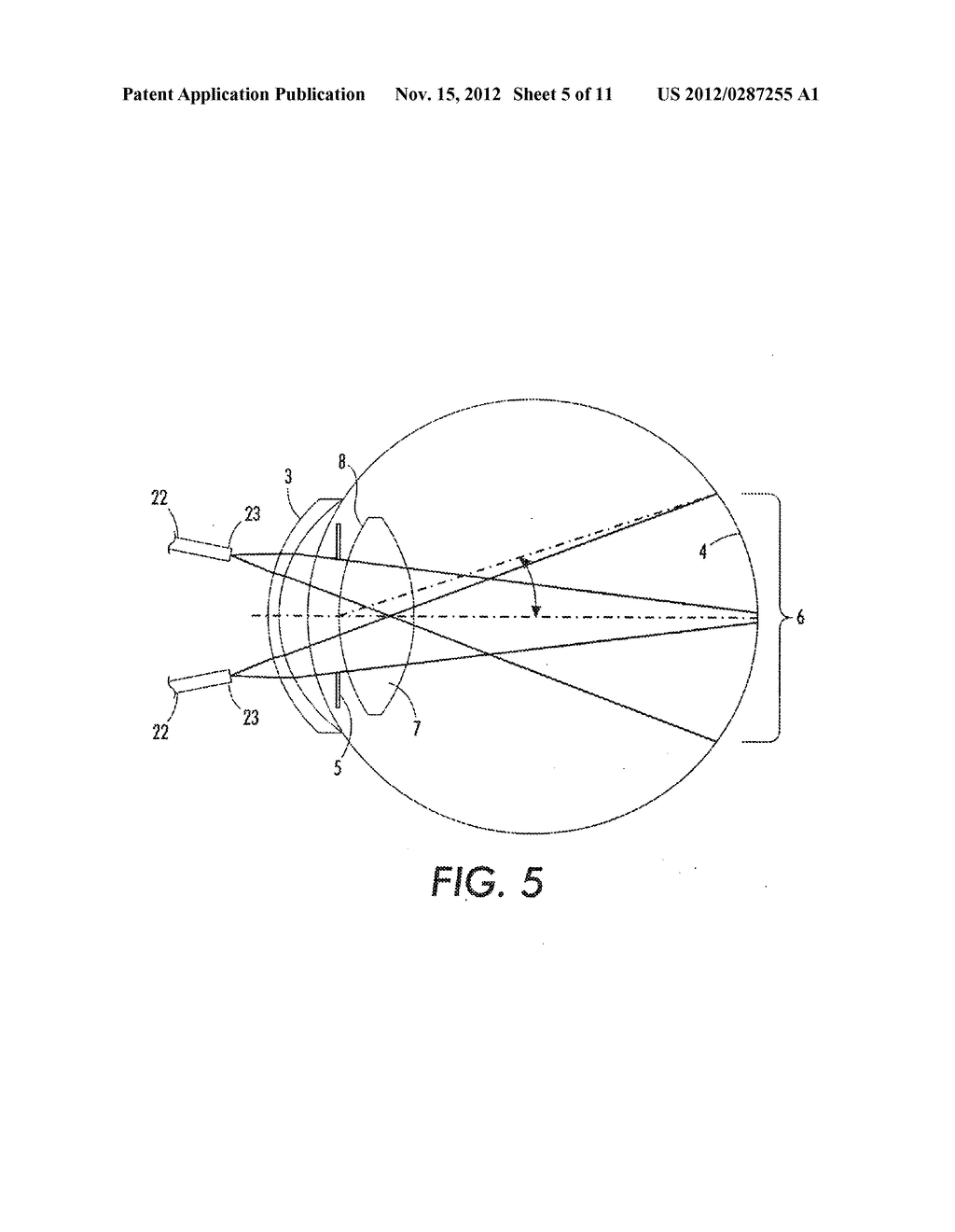 PORTABLE FUNDUS CAMERA - diagram, schematic, and image 06