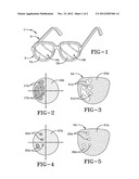 SYSTEM AND METHOD FOR REHABILITATING VISUAL DEFECTS diagram and image