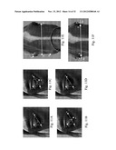 IMAGE ANALYSIS FOR DETERMINING CHARACTERISTICS OF ANIMALS diagram and image