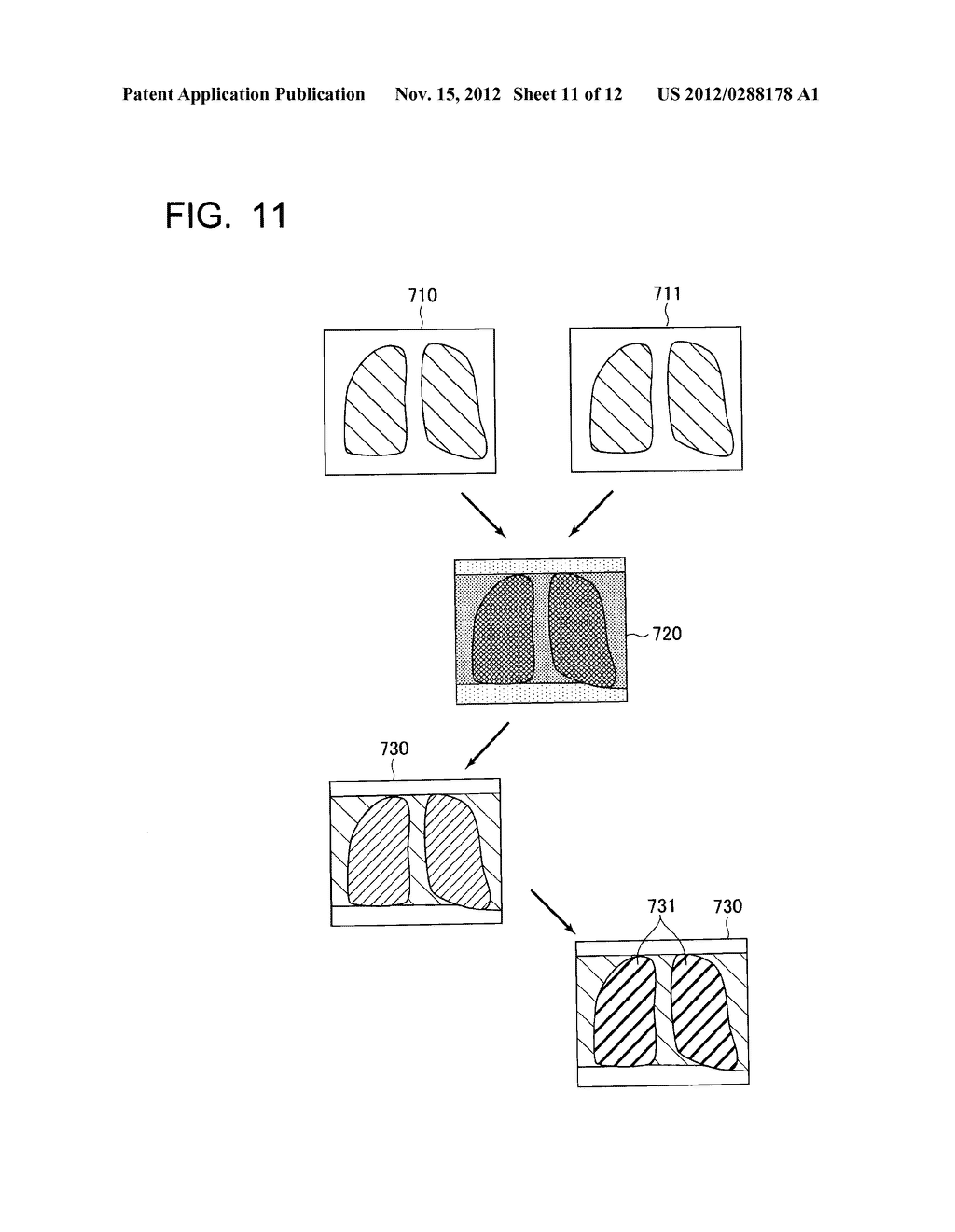 MEDICAL IMAGE PROCESSING APPARATUS, A MEDICAL IMAGING APPARATUS, AND A     METHOD OF PROCESSING MEDICAL IMAGES - diagram, schematic, and image 12