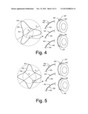 CENTERING MECHANISMS FOR TURBOCHARGER BEARINGS diagram and image