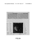 Nuclear Imaging Method Using Molecular Target Detection Agent for Liver     Fibrosis diagram and image