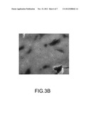 Nuclear Imaging Method Using Molecular Target Detection Agent for Liver     Fibrosis diagram and image