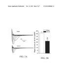 Method for Ameliorating or Preventing Arrhythmic Risk Associated with     Cardiomyopathy diagram and image