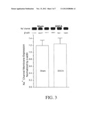 Method for Ameliorating or Preventing Arrhythmic Risk Associated with     Cardiomyopathy diagram and image