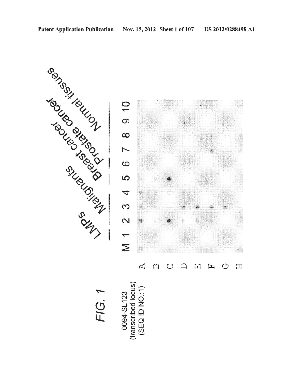 POLYNUCLEOTIDES AND POLYPEPTIDE SEQUENCES INVOLVED IN CANCER - diagram, schematic, and image 02