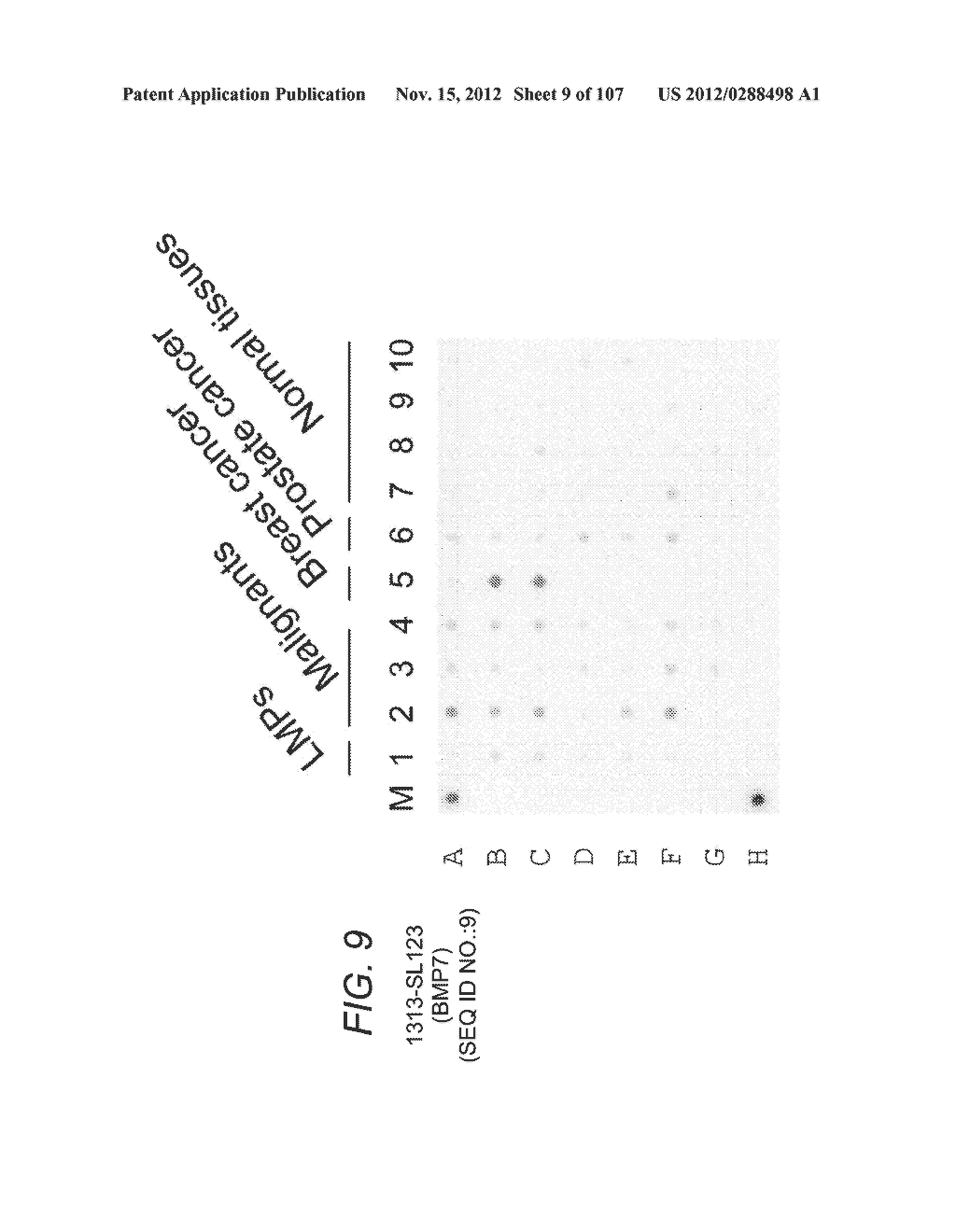 POLYNUCLEOTIDES AND POLYPEPTIDE SEQUENCES INVOLVED IN CANCER - diagram, schematic, and image 10