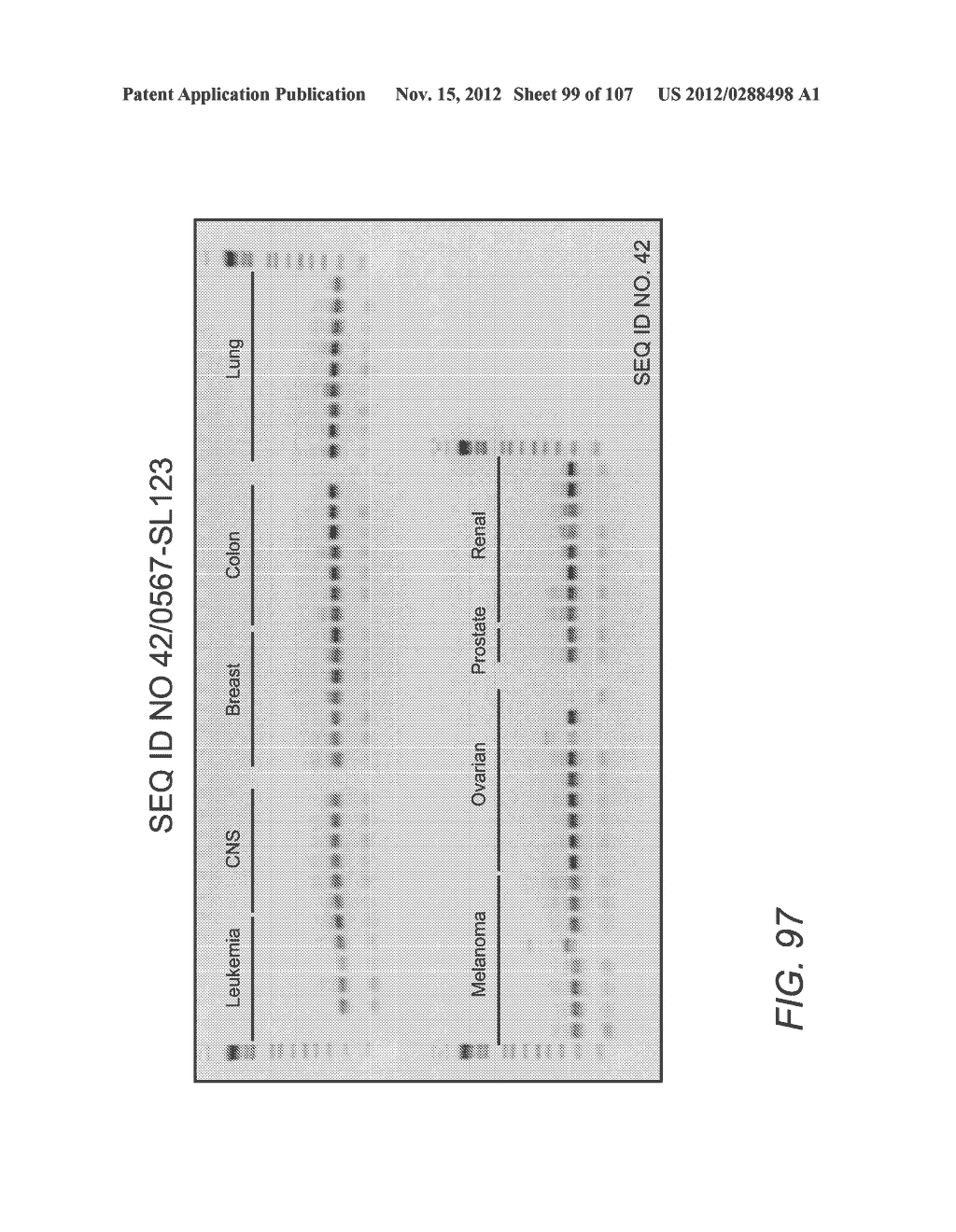 POLYNUCLEOTIDES AND POLYPEPTIDE SEQUENCES INVOLVED IN CANCER - diagram, schematic, and image 100