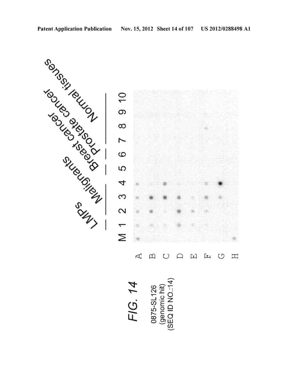 POLYNUCLEOTIDES AND POLYPEPTIDE SEQUENCES INVOLVED IN CANCER - diagram, schematic, and image 15