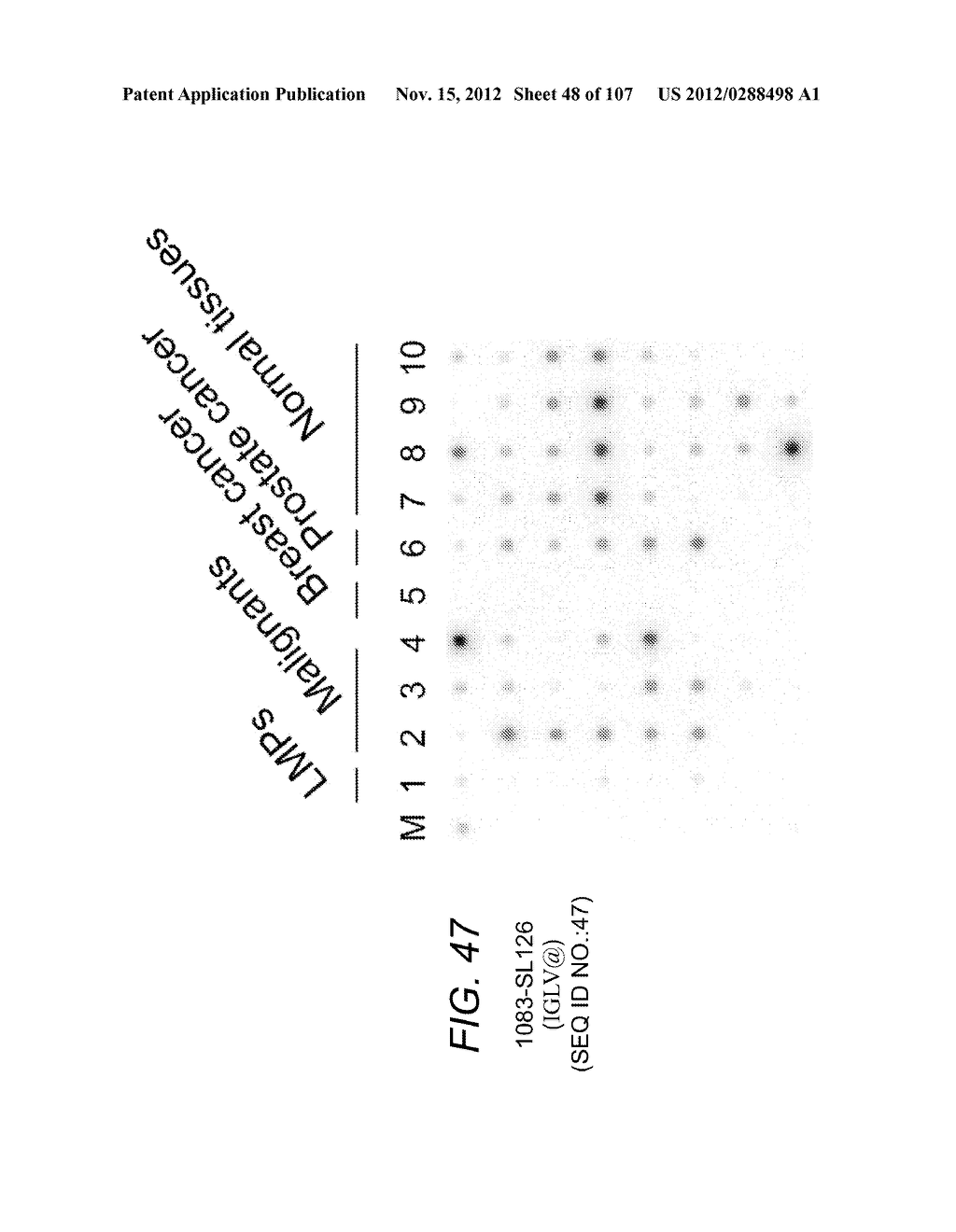 POLYNUCLEOTIDES AND POLYPEPTIDE SEQUENCES INVOLVED IN CANCER - diagram, schematic, and image 49