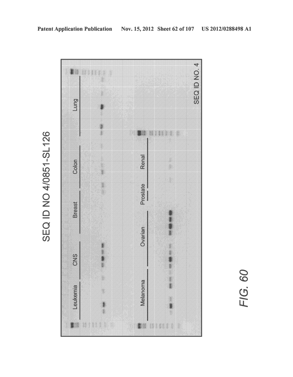 POLYNUCLEOTIDES AND POLYPEPTIDE SEQUENCES INVOLVED IN CANCER - diagram, schematic, and image 63