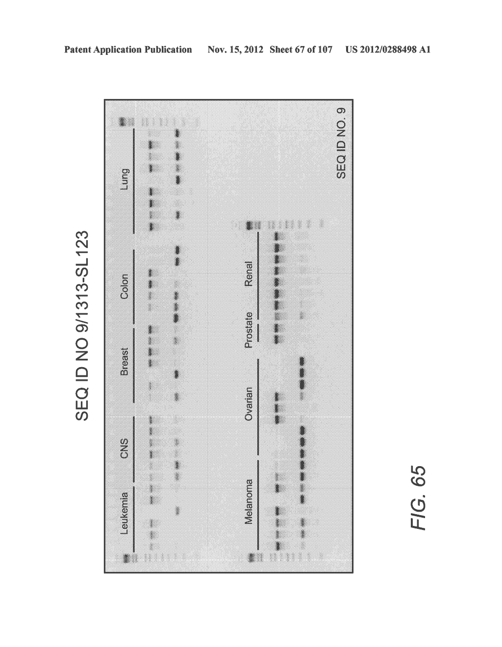 POLYNUCLEOTIDES AND POLYPEPTIDE SEQUENCES INVOLVED IN CANCER - diagram, schematic, and image 68