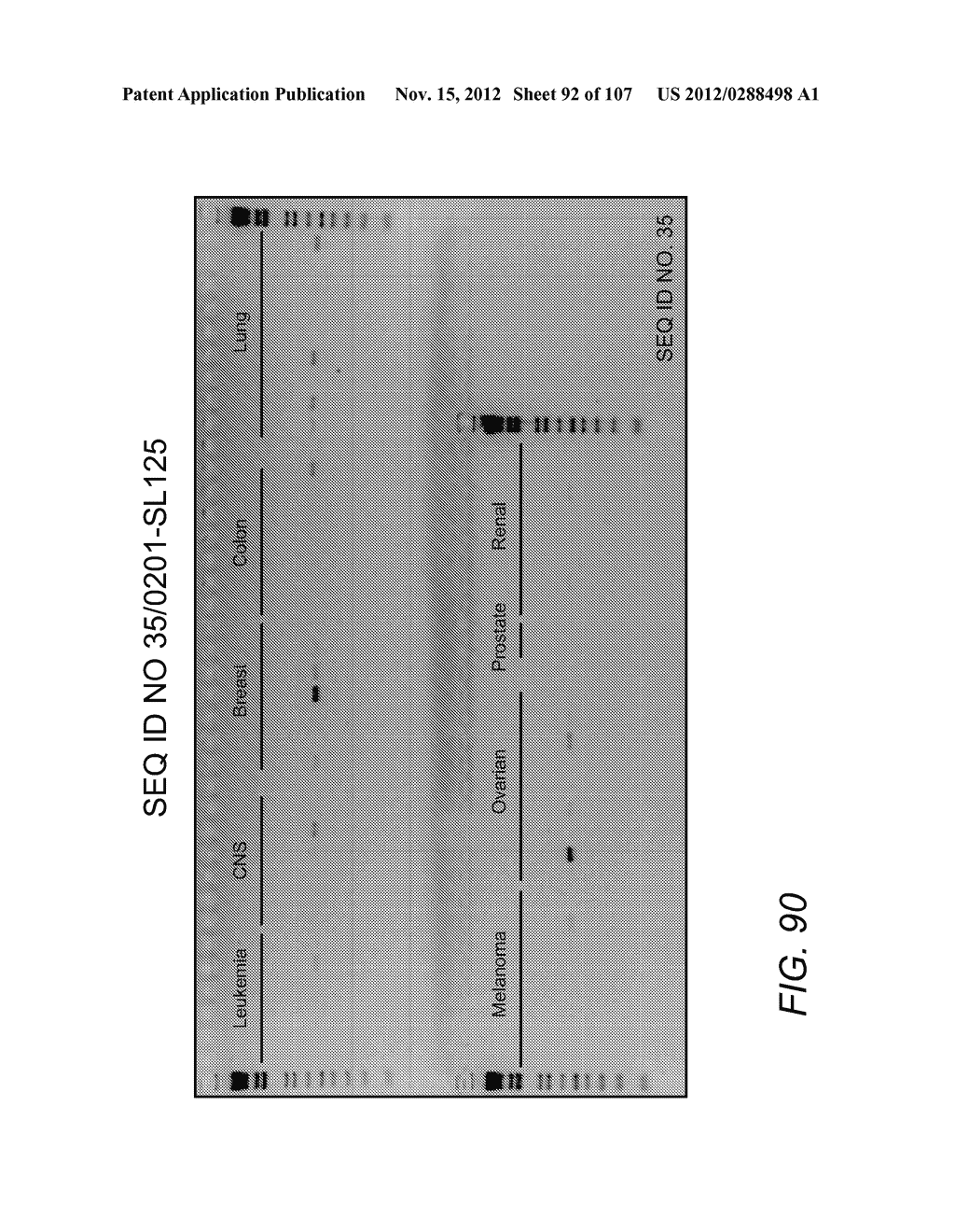 POLYNUCLEOTIDES AND POLYPEPTIDE SEQUENCES INVOLVED IN CANCER - diagram, schematic, and image 93