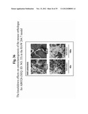 POLYNUCLEOTIDES AND POLYPEPTIDE SEQUENCES INVOLVED IN THE PROCESS OF BONE     REMODELING diagram and image