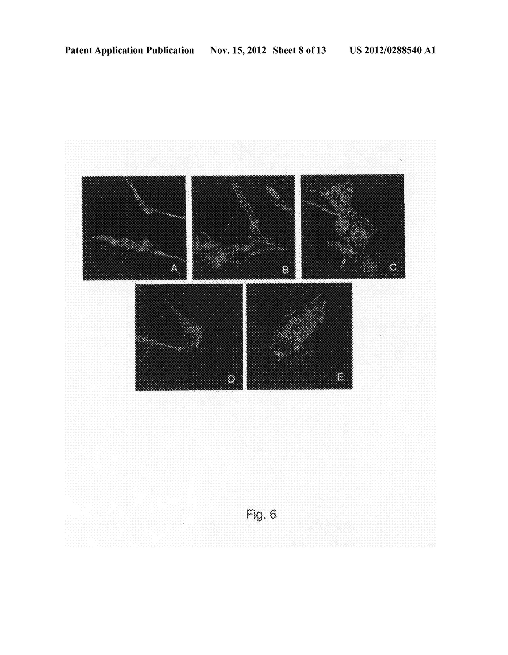 NIOSOMES, FREEZE-DRIED POWDER THEREOF AND THEIR USE IN TREATMENT - diagram, schematic, and image 09