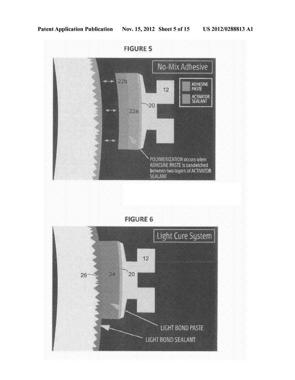 ANTI-MICROBIAL ORTHODONTIC COMPOSITIONS AND APPLIANCES AND METHODS OF     PRODUCTION AND USE THEREOF - diagram, schematic, and image 06