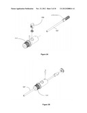 METHOD AND DEVICE FOR CAUSING TOOTH MOVEMENT diagram and image