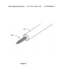 METHOD AND DEVICE FOR CAUSING TOOTH MOVEMENT diagram and image