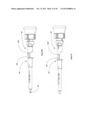 METHOD AND DEVICE FOR CAUSING TOOTH MOVEMENT diagram and image