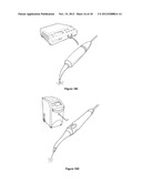 METHOD AND DEVICE FOR CAUSING TOOTH MOVEMENT diagram and image