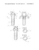 Dental Implants and Methods for Their Insertion into Patients diagram and image