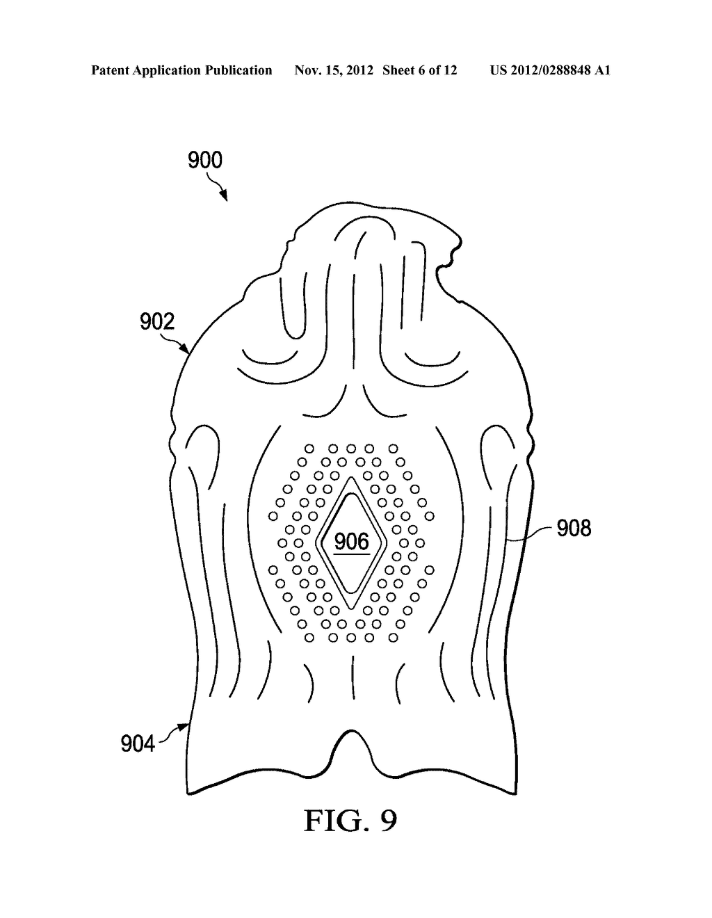 Multi-Dimensional Flow Pad Technology for Covering Three-Dimensional Dome     Shaped Anatomies - diagram, schematic, and image 07