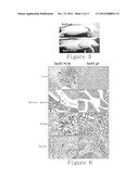 NOVEL IDENTIFIED ONCOGENE WITH KINASE-DOMAIN (NOK) diagram and image