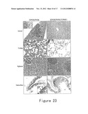 NOVEL IDENTIFIED ONCOGENE WITH KINASE-DOMAIN (NOK) diagram and image