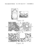 NOVEL IDENTIFIED ONCOGENE WITH KINASE-DOMAIN (NOK) diagram and image