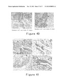 NOVEL IDENTIFIED ONCOGENE WITH KINASE-DOMAIN (NOK) diagram and image