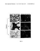 COMPOSITIONS AND METHODS FOR TREATING AND/OR PREVENTING CANCER BY     INHIBITING FATTY ACID BINDING PROTEINS diagram and image