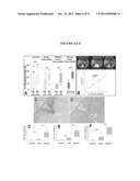 Lipase Inhibitors for the Treatment of Pancreatitis and Organ Failure diagram and image